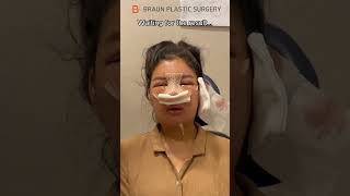I cried when watching this...😭 #fyp #glowup #facialcontouringsurgery #rhinoplasty #plasticsurgery