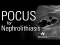 POCUS for Nephrolithiasis