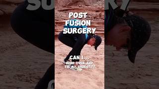Flexibility After Fusion... What to Expect
