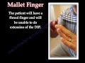 Mallet Finger - Everything You Need To Know - Dr. Nabil Ebraheim