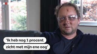 JAARWISSELING: Vuurwerkslachtoffer Paul kreeg  'de volle laag'