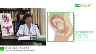 習慣性流產的婦女保胎做宮頸環紮效果好不好？Is it good for women with habitual abortion to have a cervix cer..