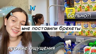 МНЕ ПОСТАВИЛИ БРЕКЕТЫ // БОЛЬНО?! // Первые ощущения