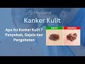 KANKER KULIT - Penyebab, Gejala dan Cara Mengobati #berobatkepenang #kankerkulit #kanker #medisehat