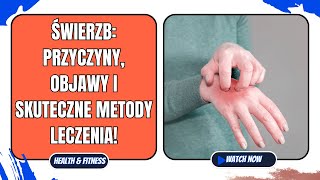 Świerzb: Przyczyny, objawy i skuteczne metody leczenia!