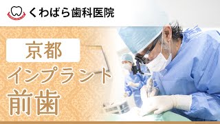 【京都】インプラントで前歯をきれいに｜医療法人 くわばら歯科医院