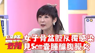 女子骨盆腔反覆感染！檢查驚見5cm囊腫釀腹膜炎！【#醫師好辣】20230827 EP1561 part3