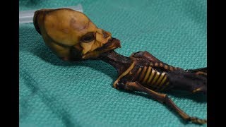 This Weird Skeleton Is Definitely Not an Alien