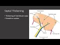 Terminology in CXR imaging