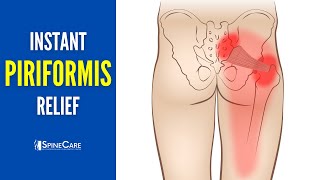 How to INSTANTLY Relieve Piriformis Pain