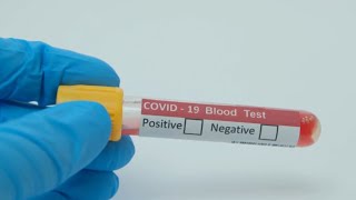 Houston Sees Spike in HIV, STIs as Vital Health Services Face Cuts