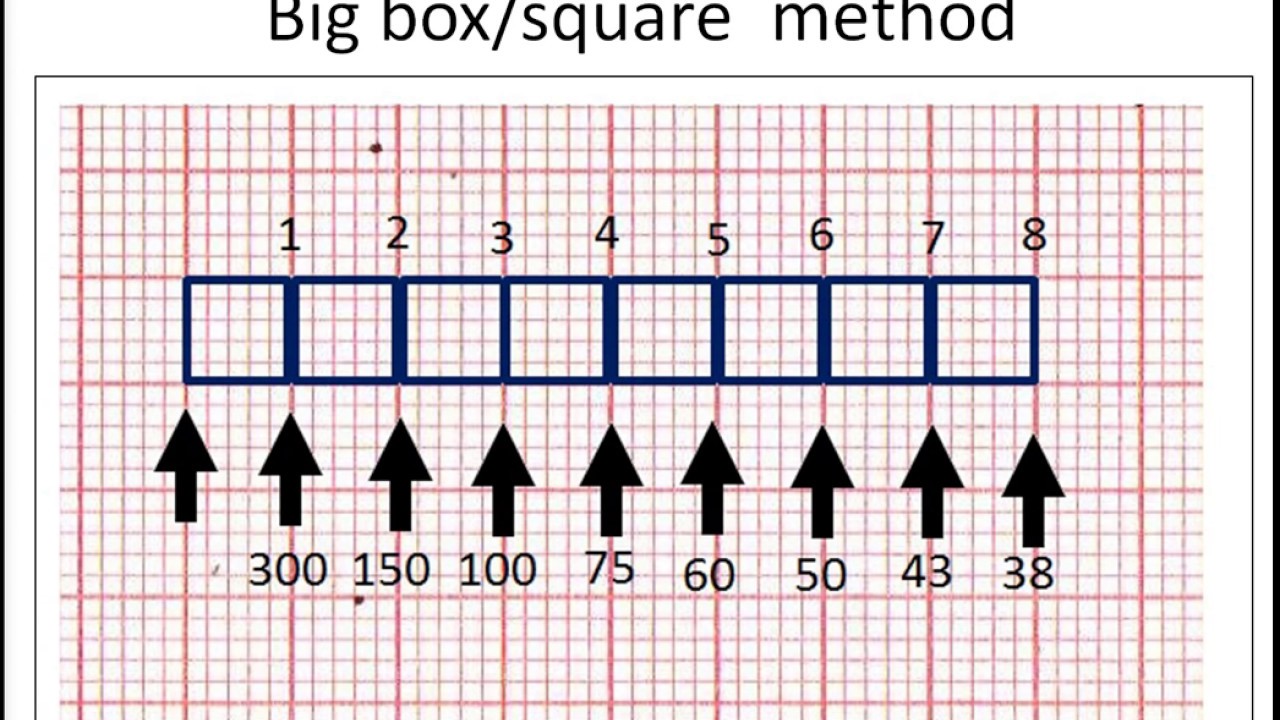 Ekg Heart Rate Scale