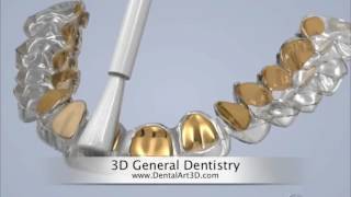 DentalArt3D  3D General Dentistry