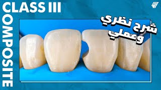 class 3 composite restoration _ شرح نظري وعملي