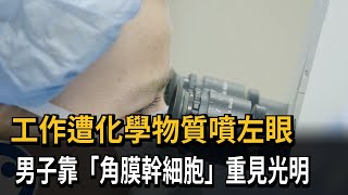 工作遭化學物質噴左眼　男子靠「角膜幹細胞」重見光明－民視新聞