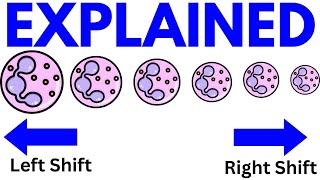 CBC Left Shift vs Right Shift | Differential Count Explained (USMLE & Exams)