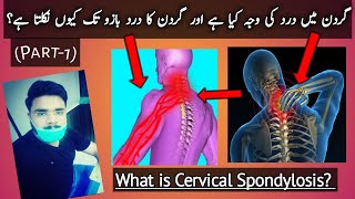 گردن کا درد کیا ہے؟ گردن کا درد بازو میں کیوں پھیلتا ہے؟ || What is Cervical Spondylosis ? || Part-1