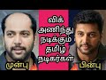 சொட்ட தலையும் தமிழ் நடிகர்களும் | Bald actors in tamil cinema | Tamil actors without wig photos