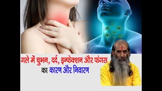 Learn from Guruji the cause and prevention of prickling, sore throat, infection and fungus. Throat Home Remedy ||