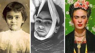 A Trágica História De Frida Kahlo