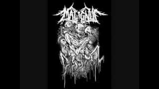 Malignus - Anatomy of Another World