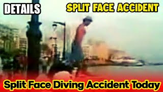 Split Face Diving Accident Today Details Face Split Diving Accident Split Face Accident