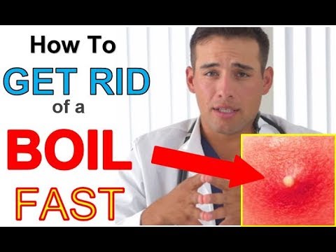 How To Get RID Of A Boil FAST At Home (3 STEPS) | Quickest Way To GET ...