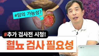 혈뇨 추가 검사 필요성(미세혈뇨, 현미경적혈뇨, 혈뇨검사)-서울대 전문의