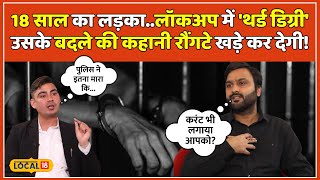 Advocate Amit Chaudhary Exclusive: 18 साल के लड़के पर पुलिस टॉर्चर की कहानी, अब बने वकील | #local18