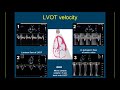 guideline based webinar on the echo assessment of aortic valve stenosis