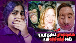 ❌چارلا نش زنی که مورد حمله شامپانزه قرار گرفت I Travis the Chimp❌