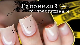 УКРЕПЛЕНИЕ КОРОТКИХ НОГТЕЙ | Что делать с гипонихием?