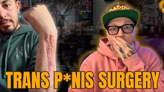 My Meat Tube - "What The Hell Did I Do To My Body!"