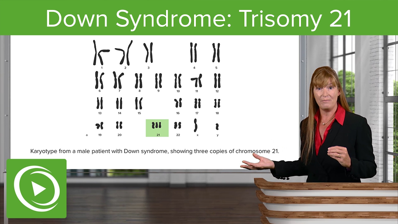 Down Syndrome: Trisomy 21 – Medical Genetics | Lecturio - YouTube