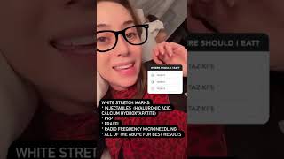 How To Treat Stretch Marks #shorts