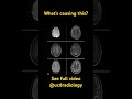 What’s causing the seizure? #radiologyresident #radiologist #medicine #radiology #neuroscience