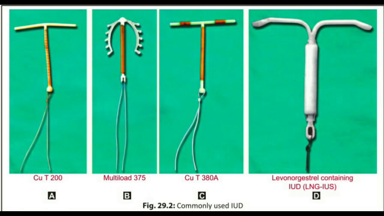 Intrauterine Contraceptivedevice Intrauterine Device Iud 54 Off