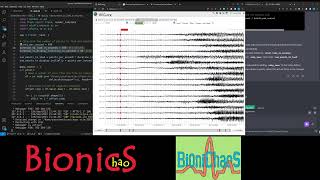 EEG with Seizures Web Application (Plotly Pandas Flask)