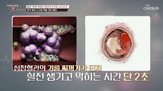 🚨심근경색 주의보🚨 순식간에 꽉 막히는 혈관🩸  TV CHOSUN 230512 방송  | [메디컬다큐 명의보감] 1회 | TV조선