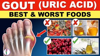 Uric acid Foods to Avoid | Gout Diet Meal Plan | Gout | Uric acid - Best & Worst Foods