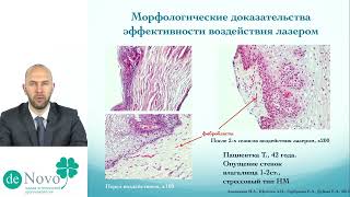 Фракционный фототермолиз в гинекологии. Школа эстетической урогинекологии de Novo модуль №4