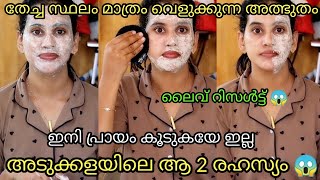 Evide തേച്ചാലും അവിടെ മാത്രം വെളുക്കുന്ന അത്ഭുതം