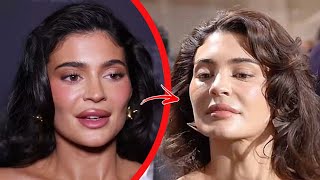Top 10 Celebrities Who Destroyed Their Face With Plastic Surgery