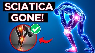 Fix Your Sciatica: 3 Diagnostic Tests and 3 Exercises for Pain Relief!