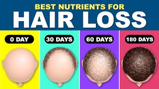Hair fall Treatment | Hair Loss Treatment for Men | How to stop hair fall | Hair Regrowth-NUTRIENTS