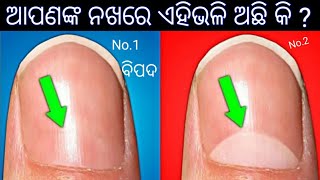 ଆପଣଙ୍କ ନଖରେ ଏହିଭଳି ଚିହ୍ନ ଅଛି କି ? ଯଦି ଅଛି ତେବେ ଆପଣ ବହୁତ୍ ଭଲ ରେ ରହିବେ ।।