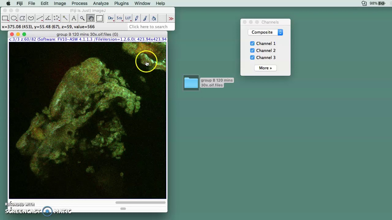 Fiji Imagej Plugins Baseballserg Fiji Imagej Plugins Baseballserg