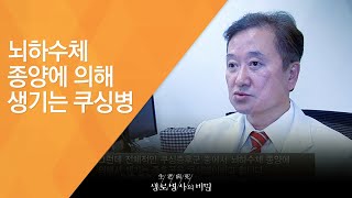 뇌하수체 종양에 의해 생기는 쿠싱병 - (20131204_485회 방송)_소리없는 저격수 - 뇌하수체 호르몬