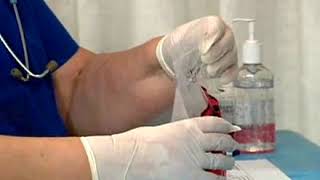 Preparing urine specimens for transport