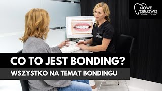 CO TO JEST BONDING?